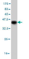 Western blot against tagged recombinant protein immunogen using ab57106 DFNB31 antibody at 1ug/ml.