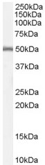 Anti-DGAT1 antibody (ab59034) at 0.5 µg/ml + Human Duodenum lysate (35µg protein in RIPA buffer)