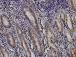 DHODH antibody (ab54621) used in immunohistochemistry at 3ug/ml on formalin fixed and paraffin embedded human stomach.