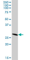 Anti-DHRS4L2 antibody (ab69394) at 1/500 dilution + DHRS4L2 human kidney lysate at 25 µgSecondaryGoat Anti-Mouse IgG (H&L)-HRP Conjugate at 1/2500 dilution