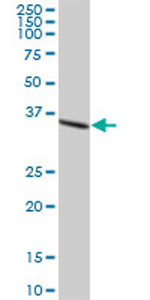Anti-DHRS7 antibody (ab69348) at 1/500 dilution + human kidney tissue lysate at 25 µgSecondaryGoat Anti-Mouse IgG (H&L)-HRP Conjugate at 1/2500 dilution
