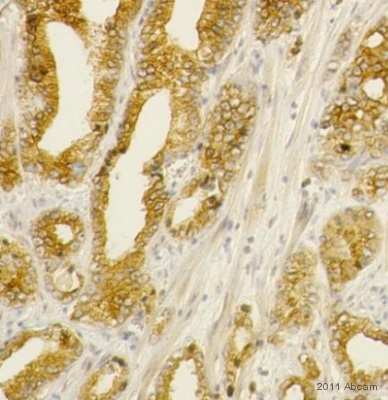 IHC-P image of DHRS7 (ab69348) on Human Pancreas sections. The sections were fixed in paraformaldehyde and underwent heat mediated antigen retrieval using Novacastra (pH6). The sections were then blocked in H2O2 solution for 10 mins at 22°C.See Abreview