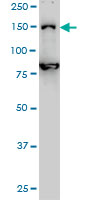DHX8 antibody (ab54592) at 1ug/lane + HeLa cell lysate at 25ug/lane.