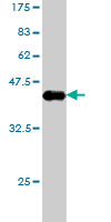 Western blot against tagged recombinant protein immunogen using ab54629 DIAPH1 antibody at 1ug/ml.