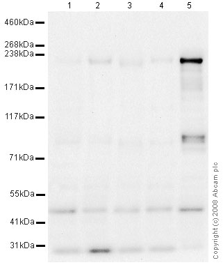 All lanes : Anti-Dicer antibody (ab5818) at 2 µg/mlLane 1 : HeLa Whole Cell Lysate at 10 µgLane 2 : Jurkat (Human T cell lymphoblast-like cell line) Whole Cell Lysate at 10 µgLane 3 : HEK293 (Human embryonic kidney cell line) Whole Cell Lysate at 10 µgLane 4 : U2OS (Human osteosarcoma cell line) Whole Cell Lysate at 10 µgLane 5 : HEK293 Whole Cell Lysate Overexpressing Dicer at 5 µgSecondaryGoat polyclonal to Rabbit IgG - H&L - Pre-Adsorbed (HRP) at 1/3000 dilutionPerformed under reducing conditions.