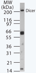 ab13502 at a 1/1000 dilution staining approximately 217kDa Dicer in 15µg of mouse ovary tissue lysate by western blot (ECL).