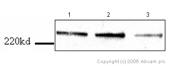 All lanes : Anti-Dicer antibody [13D6] - ChIP Grade (ab14601) at 2.5 µg/mlLane 1 : human B cell lymphoma lysateLane 2 : human B cell lymphoma lysate infected with control shRNA retrovirusLane 3 : human B cell lymphoma lysate infected with Dicer knockdown shRNA virusLysates/proteins at 2.5 µg/ml per lane.Observed band size : 225 kDa (why is the actual band size different from the predicted?)Jing Huang and Elliot Epner Oregon Health and Science University