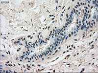 ab117984, at 1/50 dilution, staining Dihydrofolate reductase (DHFR) in paraffin-embedded Human breast tissue by Immunohistochemistry.