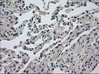 ab117984, at 1/50 dilution, staining Dihydrofolate reductase (DHFR) in paraffin-embedded Human lung tissue by Immunohistochemistry.