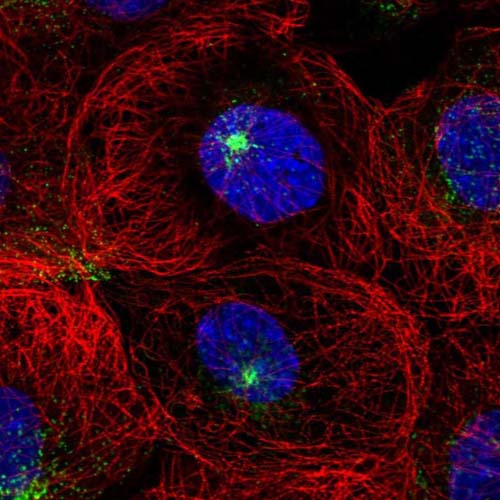 Immunofluorescent staining of Human cell line A-431 shows positivity in vesicles and centrosome. Recommended concentration of ab121844 1-4 µg/ml. Cells treated with PFA/Triton X-100.