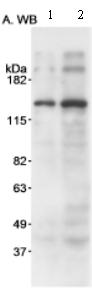 All lanes : Anti-DIS antibody (ab70244) at 1 µg/mlLane 1 : Nuclear extract from HeLa cells at 15 µgLane 2 : Nuclear extract from HeLa cells at 45 µg