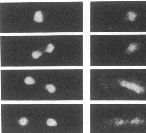 Immunfluorescent analysis of S. pombe cells labeling Dis3 with ab64289 (right panel). DAPI stain for chromosomal DNA (left panel).