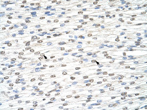 Immunohistochemistry (Formalin/PFA-fixed paraffin-embedded sections) analysis of human heart tissue labelling DIS3L2 with ab50848 at 4-8µg/ml. Arrows indicate positively stained human myocardial cells. Magnification: 400X.