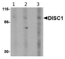 Lane 1 :  Anti-DISC1 antibody (ab62069) at 0.5 µg/mlLane 2 :  Anti-DISC1 antibody (ab62069) at 1 µg/mlLane 3 :  Anti-DISC1 antibody (ab62069) at 2 µg/mlLane 1 : SK-N-SH cell lysateLane 2 : SK-N-SH cell lysateLane 3 : SK-N-SH cell lysateLysates/proteins at 10 µg per lane.Secondaryanti-rabbit IgG