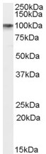 Anti-DISC1 antibody (ab59017) at 0.1 µg/ml + Human Brain (Hippocampus) lysate (35µg protein in RIPA buffer)