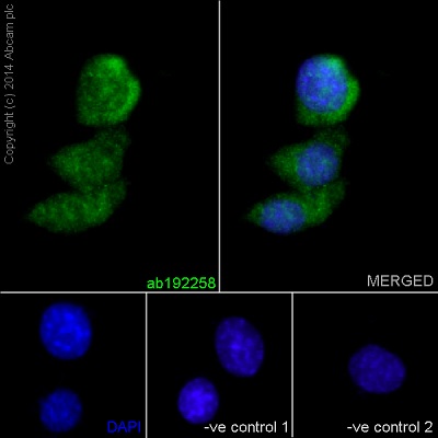 Immunofluorescent analysis of 4% formaldehyde fixed Neuro-2a cells labeling DISC1 using ab192258 at a 1/100 dilution. A Goat anti rabbit IgG (Alexa Fluor®488) ab150077 was used as the secondary at a 1/200 dilution. Permeabilized using 0.1% Triton X-100. Counterstained with DAPI. The two negative controls: 1. Primary ab concentration (anti-DISC1 ) is 1:1000 dilution, Secondary ab (Goat anti mouse IgG (Alexa Fluor®594)) is 1:500 dilution; 2. Primary ab concentration (anti-DISC1 ) is 1:1000 dilution, Secondary ab (Goat anti mouse IgG (Alexa Fluor®594)) is 1:500 dilution.