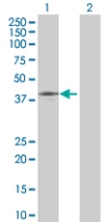 All lanes : Anti-DIXDC1 antibody (ab67763) at 1/500 dilutionLane 1 : DIXDC1 transfected lysateLane 2 : Non transfected lysate. Lysates/proteins at 25 µg per lane.SecondaryGoat anti-mouse IgG (H&L)-HRP conjugate at 1/2500 dilution