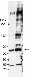 Lane 1 :  Anti-DKFZP434B168 antibody (ab17256) at 1/25000 dilutionLane 2 :  Anti-DKFZP434B168 antibody (ab17256) at 1/10000 dilutionLane 1 : Nuclear lysates prepared from Hela cellsLane 2 : Nuclear lysates prepared from Hela cellsObserved band size : 110 kDa (why is the actual band size different from the predicted?)Sample: Nuclear extract (NE) from HeLa cells. Antibody: ab17256 at 0.1 ug/ml. The band corresponding to DKFZP434B168 is arrowed at 110 kD. The identity of the other bands is unknown.Detection: Chemiluminescence with an exposure time of 15 minutes.We are unsure about the identity of other bands.