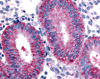 ab61034 at 10µg/ml staining formalin fixed paraffin embedded Uterus (endometrium)