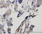 Immunoperoxidase staining of DKK1 using ab88334 at 3 µg/ml on formalin-fixed, paraffin-embedded Human placenta tissue.