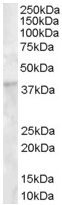 Anti-DKK1 antibody (ab22827) at 1 µg/ml + Human Bone Marrow lysate (35µg protein in RIPA buffer).
