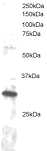 Ab2342 staining (1µg/ml) of Jurkat lysate (RIPA buffer, 30µg total protein per lane).  Primary incubated for 1 hour.  Detected by western blot using chemiluminescence.