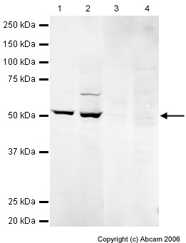 All lanes : Anti-DLK antibody (ab21682) at 1 µg/mlLane 1 : Human Embryonic Stem Cell LysateLane 2 : Mouse Embryonic Stem Cell LysateLane 3 : Human Embryonic Stem Cell Lysate with DLK peptide (ab23442) at 1 µg/mlLane 4 : Mouse Embryonic Stem Cell Lysate with DLK peptide (ab23442) at 1 µg/mlLysates/proteins at 20 µg per lane.SecondaryRabbit IgG secondary antibody (ab28446) at 1/10000 dilutiondeveloped using the ECL techniquePerformed under reducing conditions.