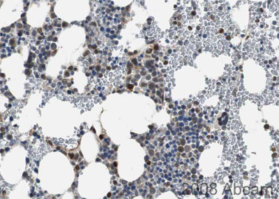 Image courtesy of Human Protein Atlasab21682 staining DLK in human bone marrow within the haemopoietic tissue and not the adipocytes. Paraffin embedded human bone marrow was incubated with ab21682 (1/150 dilution) for 30 mins at room temperature. Antigen retrieval was performed by heat induction in citrate buffer pH 6. ab21682 was tested in a tissue microarray (TMA) containing a wide range of normal and cancer tissues as well as a cell microarray consisting of a range of commonly used, well characterised human cell lines. Further results for this antibody can be found at www.proteinatlas.org.