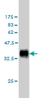 Western blot against tagged recombinant protein immunogen using ab57308 Delta like 1 antibody at 1ug/ml.