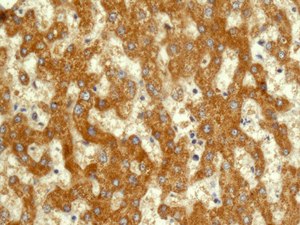 Immunohistochemical analysis of paraffin-embedded Human liver tissue labeling DLST with ab178692 at 1/100 dilution.