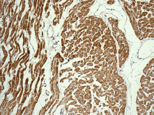 Immunohistochemical analysis of paraffin-embedded Human heart tissue labeling DLST with ab178692 at 1/100 dilution.