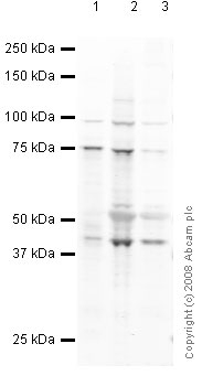 All lanes : Anti-Dlx2 antibody [mAbcam 51965] (ab51965) at 5 µg/mlLane 1 : Brain (Human) Tissue Lysate Lane 2 : Brain (Mouse) Tissue Lysate Lane 3 : Brain (Rat) Tissue Lysate Lysates/proteins at 10 µg per lane.SecondaryDonkey polyclonal to Mouse IgG (IRDyeTM 700DX) at 1/10000 dilutionPerformed under reducing conditions.
