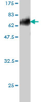 Western blot against tagged recombinant protein immunogen using ab54726 DLX3 antibody at 1ug/ml.