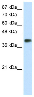 Anti-DLX3 antibody - ChIP Grade (ab66390) at 1.25 µg/ml + Transfected 293T cell lysate at 10 µgSecondaryHRP conjugated anti-Rabbit IgG at 1/50000 dilution