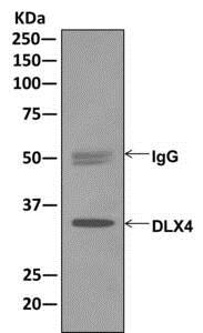 Western blot analysis on immunoprecipitation pellet from K562 cell lysate using ab175218 at 1/10 dilution.