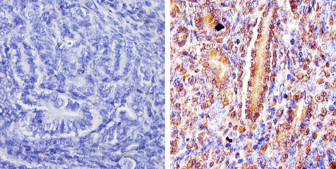 Immunohistochemistry (Formalin/PFA-fixed paraffin-embedded sections) analysis of DMAP1 showing staining in the cytoplasm and nucleus of paraffin-treated mouse uterus tissue (right) compared with a negative control in the absence of primary antibody (left). Antigen retrieval was performed using 10mM sodium citrate (pH 6.0), microwaved for 8-15 min. Tissues were blocked in 3% H2O2-methanol for 15 min at room temperature, washed with ddH2O and PBS, and then incubated with ab2848 diluted by 3% BSA-PBS at a dilution of 1:100 overnight at 4°C in a humidified chamber. Tissues were washed extensively in PBST and detection was performed using an HRP-conjugated secondary antibody followed by colorimetric detection using a DAB kit. Tissues were counterstained with hematoxylin and dehydrated with ethanol and xylene to prep for mounting.