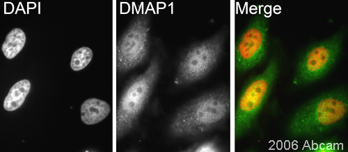 ab2848 staining DMAP1 in asynchronous HeLa cells in conjunction with a secondary goat anti-rabbit antibody conjugated to Cy3 ® (green). Cells were counterstained with DAPI (red) to show the nucleus. Please refer to abreview for further details.See Abreview