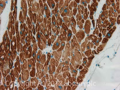 IHC image of COP1 staining in Human normal heart muscle formalin fixed paraffin embedded tissue section, performed on a Leica BondTM system using the standard protocol F. The section was pre-treated using heat mediated antigen retrieval with sodium citrate buffer (pH6, epitope retrieval solution 1) for 20 mins. The section was then incubated with ab56400, 5µg/ml, for 15 mins at room temperature and detected using an HRP conjugated compact polymer system. DAB was used as the chromogen. The section was then counterstained with haematoxylin and mounted with DPX.For other IHC staining systems (automated and non-automated) customers should optimize variable parameters such as antigen retrieval conditions, primary antibody concentration and antibody incubation times.