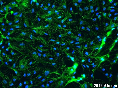 ab55812 staining cultured ED18 rat primary hippocampal neurons by ICC/IF. The cultured cells were fixed with 4% paraformaldehyde for 5 minutes and blocked with 10% donkey serum in 0.1% PBS-0.3% TritonX for 30 minutes at 24°C. The cultured cells were then stained with ab55812 at 1/200 in 0.3% TritonX with 0.1% PBS and 10% donkey serum for overnight at 4°C. An Alexa Fluro 488 donkey anti-rabbit polyclonal antibody at 1/1000 was used as the secondary antibody. Nuclei were stained with 1.43µM Hoechst and can be observed in blue.See Abreview