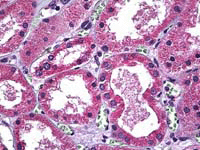 ab117544, at 5 µg/ml, staining DMT1 in Formalin-fixed, Paraffin-embedded Human Kidney tissue by Immunohistochemistry.