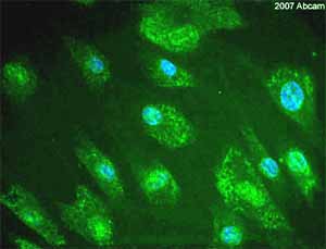 ab615 at 1/150 staining normal human primary fibroblasts by ICC/IF. The cells were paraformaldehyde fixed and blocked with BSA before incubation with the antibody for 16 hours. A FITC conjugated goat polyclonal antibody was used as the secondary.See Abreview