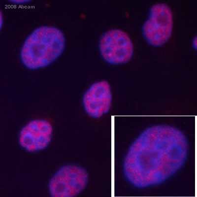 ab587 staining cultured human HeLa cells by ICC/IF.  Cells were PFA fixed and permeabilized in 0.5% Triton X100 prior to blocking in 5% BSA for 1 hour at 20°C.  The primary antibody was diluted 1/200 and incubated with the sample for 1 hour at 20°C.  A Cy3® conjugated donkey anti-mouse antibody diluted was used as the secondary.See Abreview