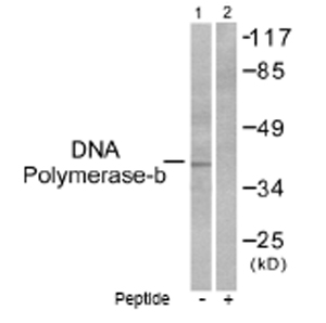 All lanes : Anti-DNA Polymerase beta antibody (ab53059) at 1/500 dilutionLane 1 : Extracts from NIH/3T3 cellsLane 2 : Extracts from NIH/3T3 cells treated with peptide