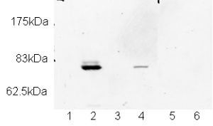 Lanes 1, 2, 5 & 6 :  Anti-DNA polymerase eta antibody (ab17725) at 1/400 dilutionLanes 3 - 4 :  Anti-DNA polymerase eta antibody (ab17725) at 1/2000 dilutionLane 1 : XP30RO cell lysate (lacking endogenous DNA polymerase eta)Lane 2 : MRC5 cell lysateLane 3 : XP30RO cell lysate (lacking endogenous DNA polymerase eta)Lane 4 : MRC5 cell lysateLane 5 : XP30RO cell lysate(lacking endogenous DNA polymerase eta) with Human DNA polymerase eta peptide (ab19077) at 5 µlLane 6 : MRC5 cell lysate with Human DNA polymerase eta peptide (ab19077) at 5 µlSecondaryGoat anti-rabbit HRP at 1/5000 dilutiondeveloped using the ECL techniquePerformed under reducing conditions.