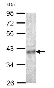 Anti-Coproporphyrinogen Oxidase (CPOX) antibody (ab96061) at 1/1000 dilution + HCT116 whole cell lysate at 30 µg