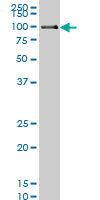 Anti-DNA Polymerase Kappa/POLK antibody (ab57070) at 1 µg + HeLa nuclear lysate at 25 µgSecondaryGoat Anti-Mouse IgG at 1/5000 dilution