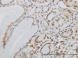 Immunohistochemical analysis of formalin-fixed, paraffin-embedded Human stomach tissue, staining DNA Polymerase Kappa/POLK with ab57070 at 3 µg/ml.