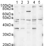 All lanes : Anti-DNA polymerase mu antibody (ab3500) at 1/500 dilutionLane 1 : HeLa nuclear lysateLane 2 : HeLa whole cell lysateLane 3 : A431 whole cell lysateLane 4 : Jurkat whole cell lysateLane 5 : HEK293 whole cell lysateLysates/proteins at 20 µg per lane.SecondaryGoat Anti-Rabbit IgG H&L (HRP) (ab6721) at 1/5000 dilutionPerformed under reducing conditions.Exposure time :  2 minutes