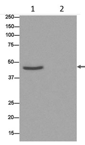 Western blot analysis of Immunoprecipitate from Human fetal brain lysate (lane 1) using ab185553 at 1/50 dilution. Lane 2: PBS used instead of Human fetal brain lysates. Secondary antibody: Anti-Rabbit IgG (HRP), specific to the non-reduced form of IgG, at 1/1500 dilution. Blocking buffer: 5% NFDM/TBST.