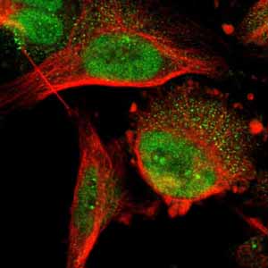 Immunofluorescent staining of Human cell line U-251 MG shows positivity in nucleoli and nucleus but not nucleoli using ab121535.Recommended treatment:Fixation/Permeabilization: PFA/Triton X-100